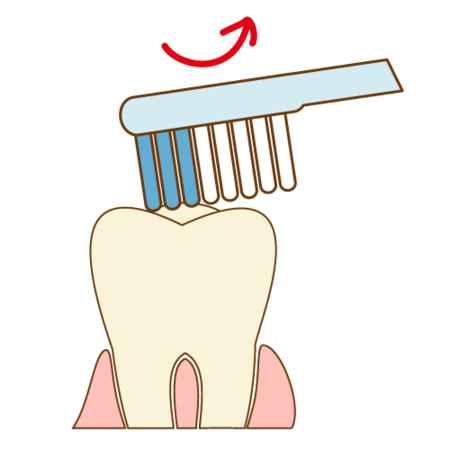 teeth-cleaning009.png